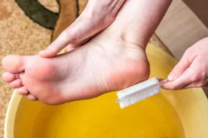 Cura e salute dei piedi, Snep Hermes