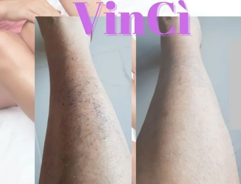 Gambe pesanti, gambe pesanti al mattino